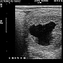 USG method for pregnancy diagnosis and monitoring in a mare.