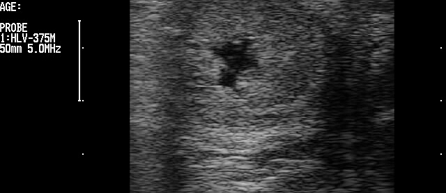 Breeding-induced endometritis in a mare.