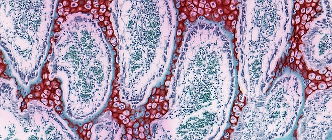 Endochondral ossification