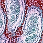 Endochondral ossification